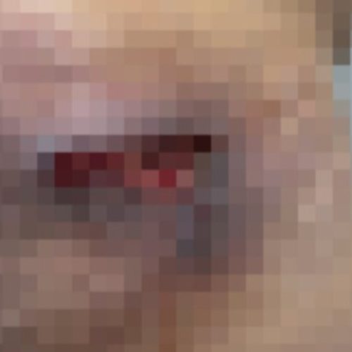 Dentista é investigada por aplicar silicone industrial em pacientes em Arapiraca