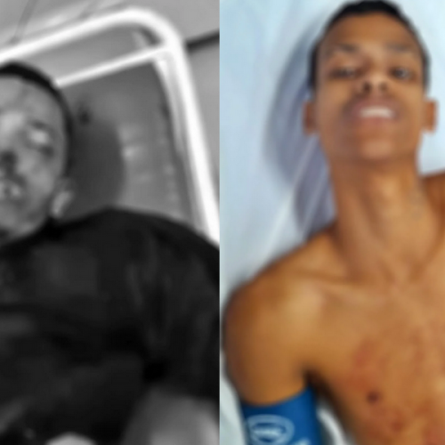 Guarda Municipal reage a tentativa de homicídio e dois suspeitos ficam feridos em São Miguel dos Campos