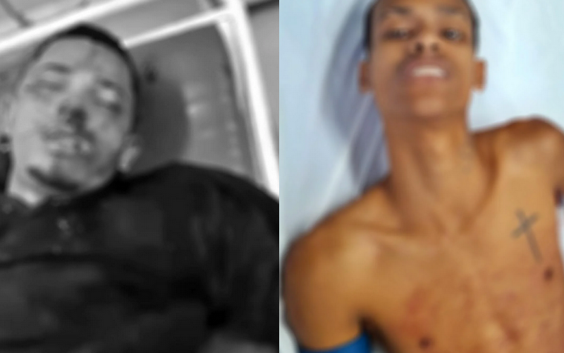 Guarda Municipal reage a tentativa de homicídio e dois suspeitos ficam feridos em São Miguel dos Campos